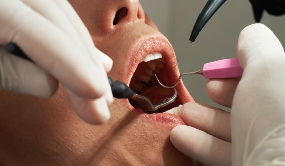 Diş Hekimi Korkusu (Dentafobia)