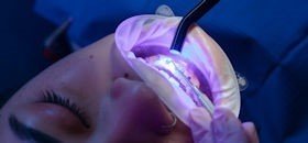 Diş Kliniği Lazer